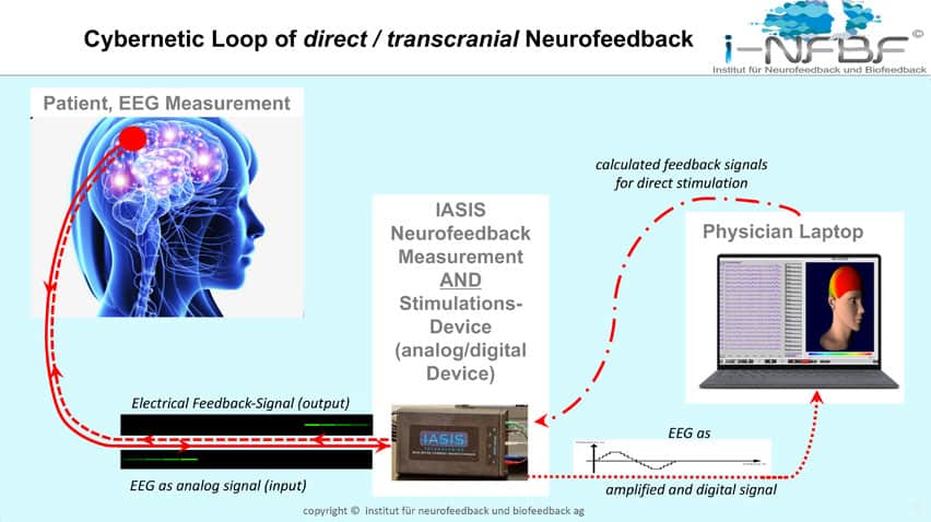 IASIS Micro Current Neurofeedback