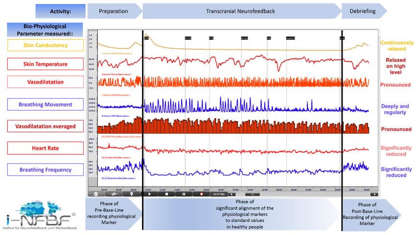 Preparation Transcranial Neurofeedback